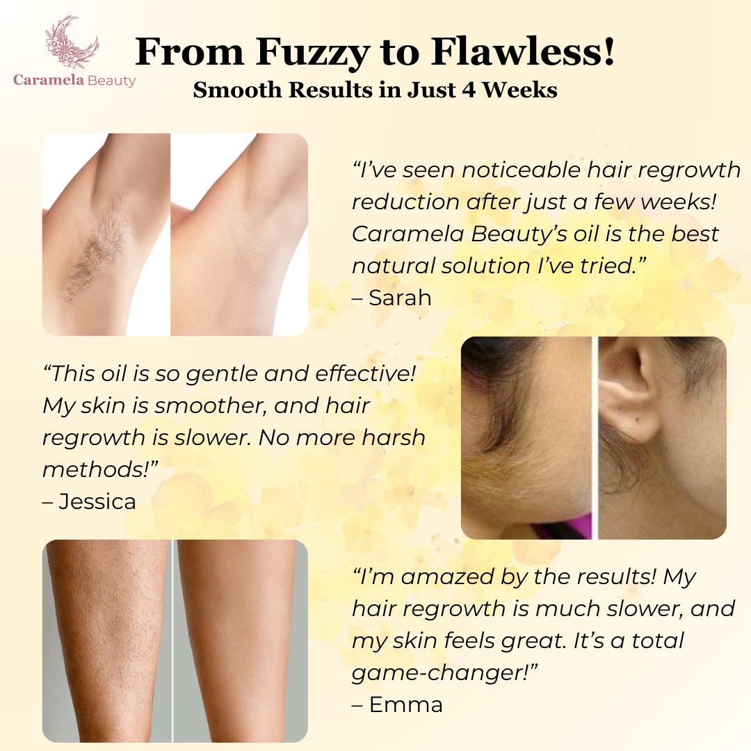 Calmskin Hair Reduction Oil 30Ml Product Image 08