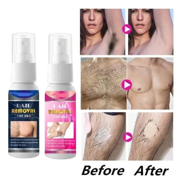 Bareease Hair Removal Spray 50Ml Product Image 01