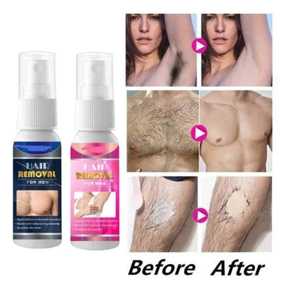 Bareease Hair Removal Spray 50Ml Product Image 01