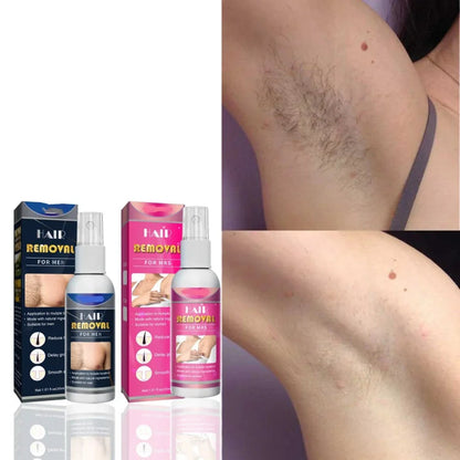 Bareease Hair Removal Spray 50Ml Product Image 05