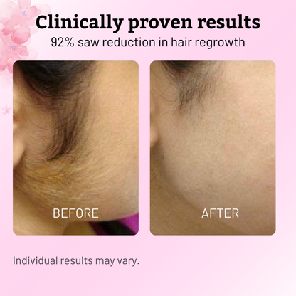 Calmskin Hair Reduction Oil 30Ml Product Image 03