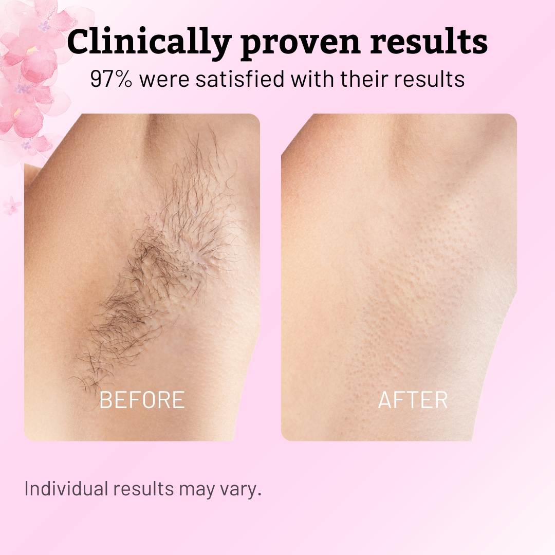 Calmskin Hair Reduction Oil 30Ml Product Image 04