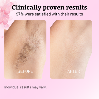 Calmskin Hair Reduction Oil 30Ml Product Image 04