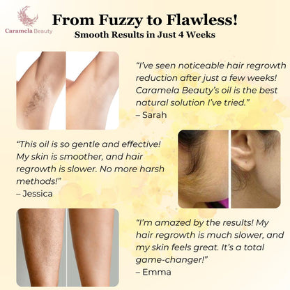 Calmskin Hair Reduction Oil 30Ml Product Image 08