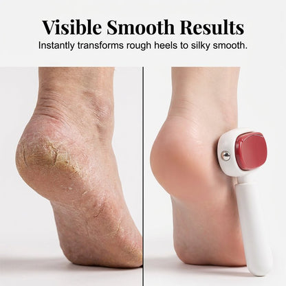 Dry Step Callus Care Stainless Foot Smoother Product Image 03