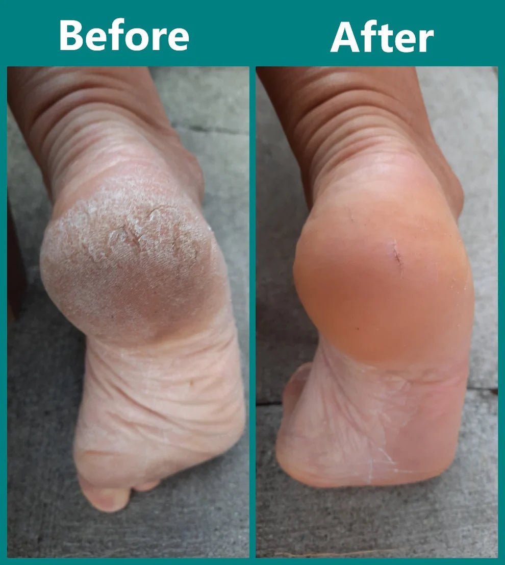 Fresco Heel Sole Waterproof Exfoliator Product Image 05