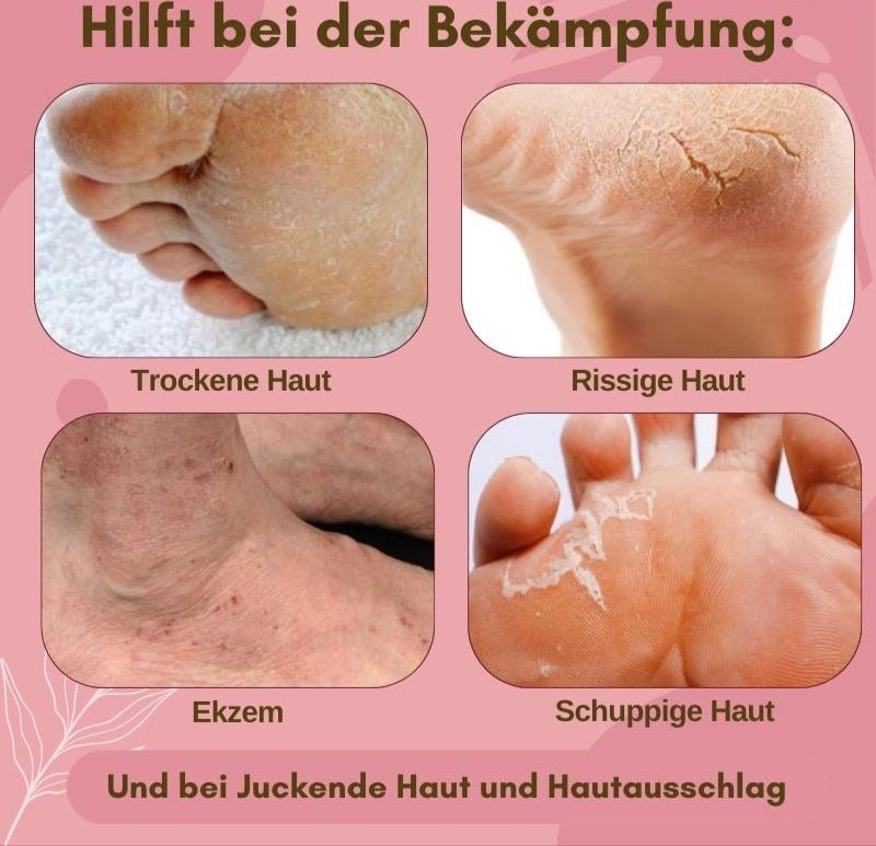 Freshstep Salicylic Foot Repair Cream Product Image 02