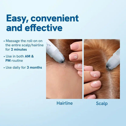 Fuller Roots Scalp Serum Roller Product Image 03