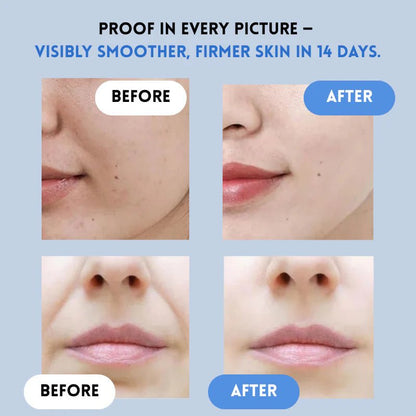 Gleamlift Hydrating Facial Smoothing Strips Product Image 04