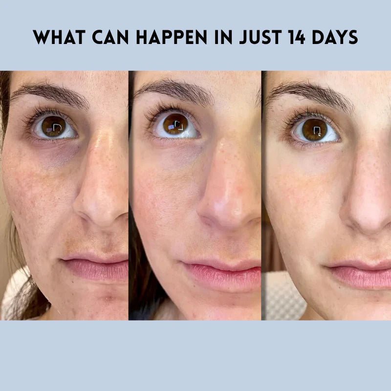 Gleamlift Hydrating Facial Smoothing Strips Product Image 06