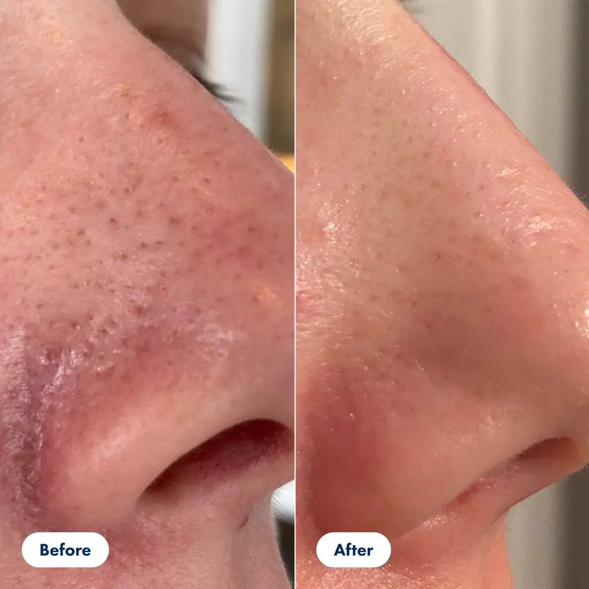 Glowveil Rice Enzyme Pore Smoothing Treatment Product Image 03
