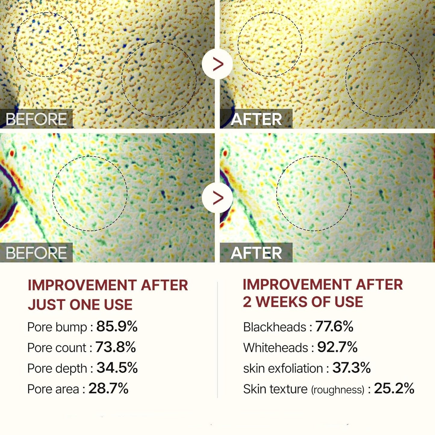 Glowveil Rice Enzyme Pore Smoothing Treatment Product Image 08