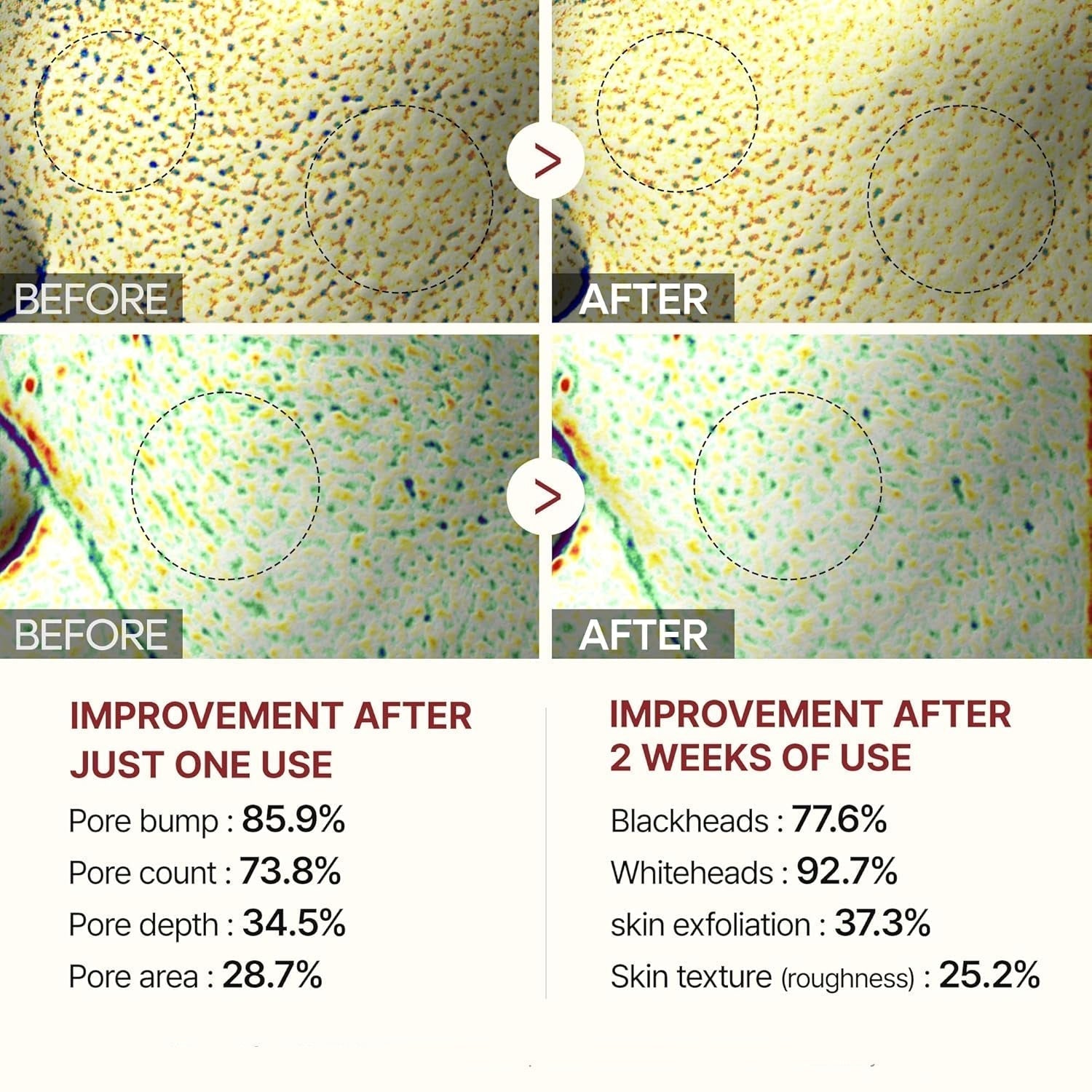 Glowveil Rice Enzyme Pore Smoothing Treatment Product Image 08