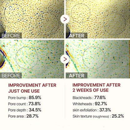 Glowveil Rice Enzyme Pore Smoothing Treatment Product Image 08