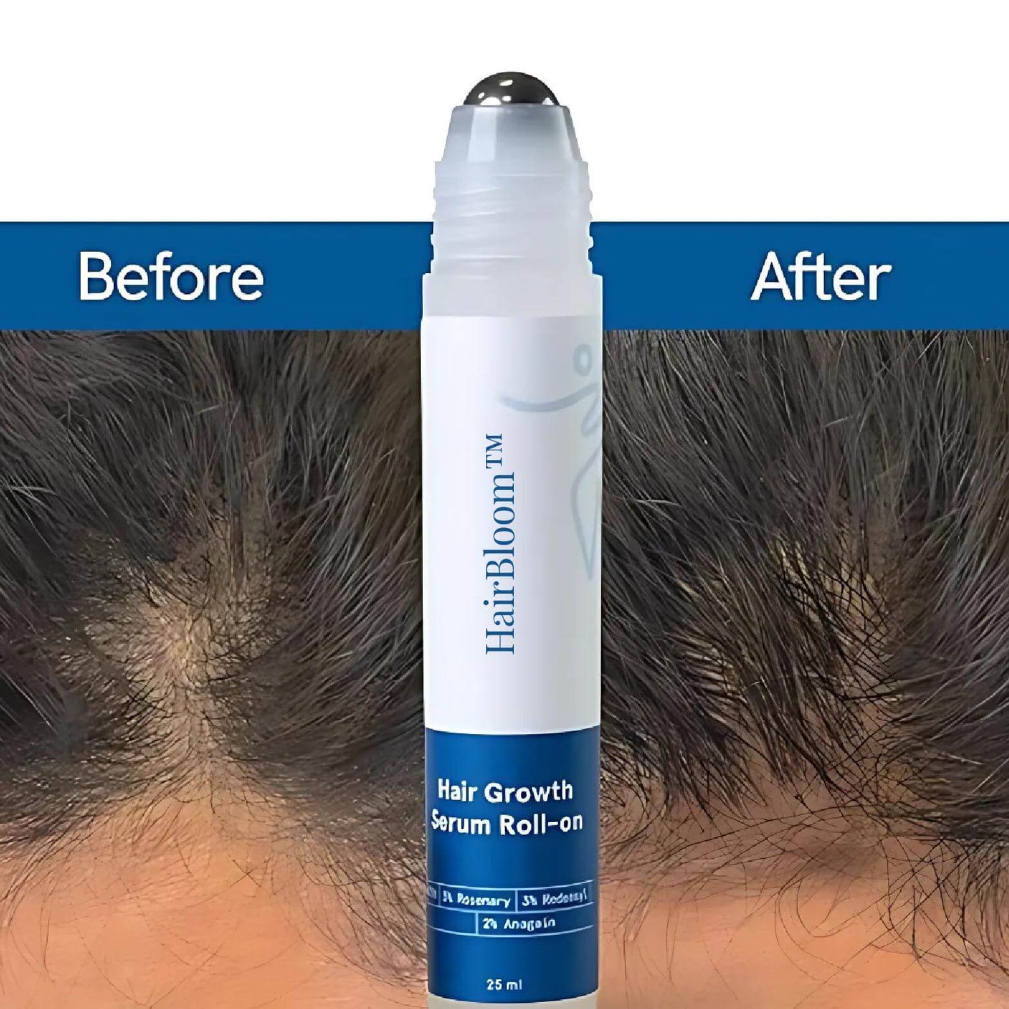 Haven Root Rosemary Scalp Roll On Serum Product Image 01