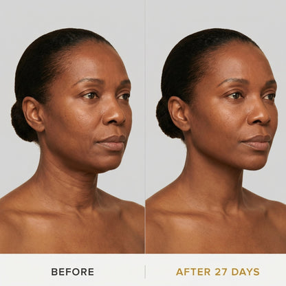 Jaw Contour Face Wrap Neck Chin Mask Product Image 03