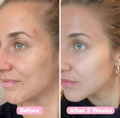 Luminous Gold Under Eye Patches Product Image 07