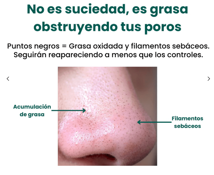 Lustrapore Hydro Suction Facial Cleaner Product Image 02