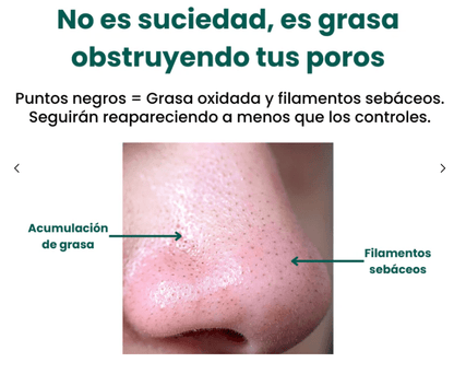 Lustrapore Hydro Suction Facial Cleaner Product Image 02