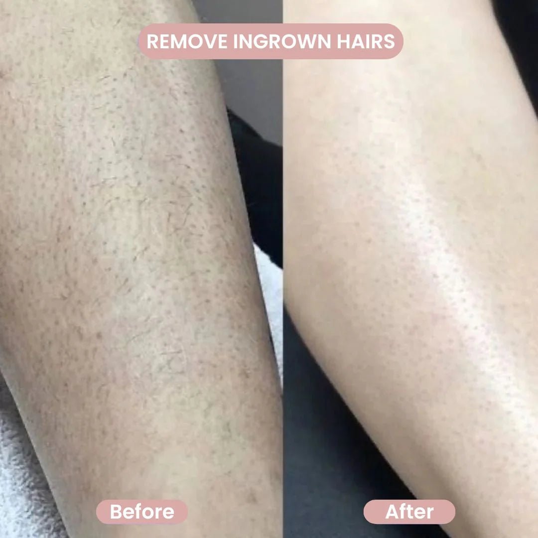Smoothease Wet Dry Womens Electric Shaver Product Image 05