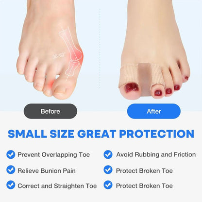 Tova Invisible Toe Separator Product Image 06