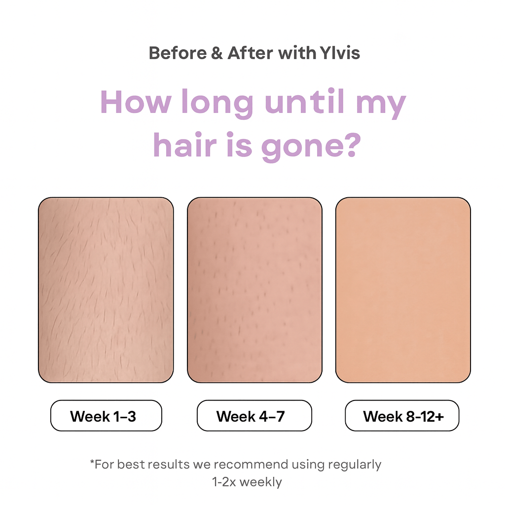 Vela Ipl Hair Removal Device Product Image 01