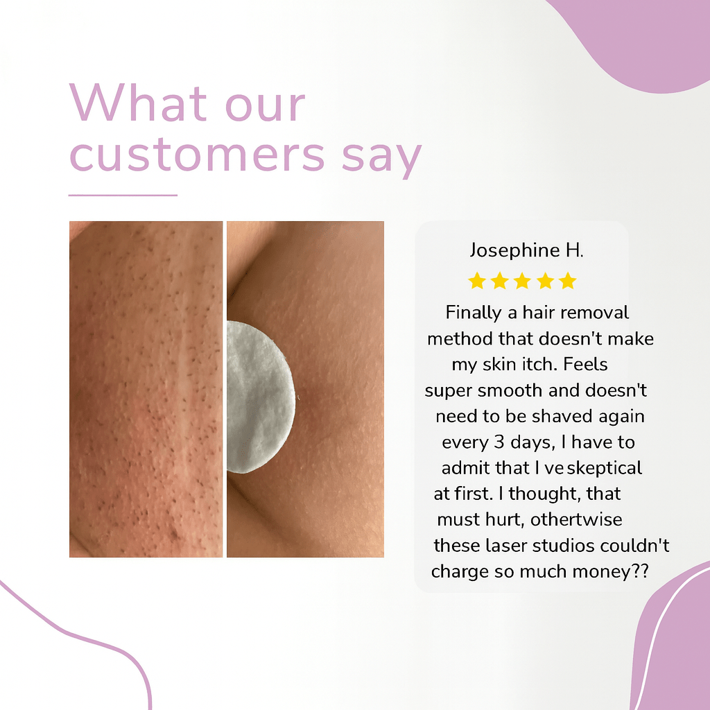 Vela Ipl Hair Removal Device Product Image 10